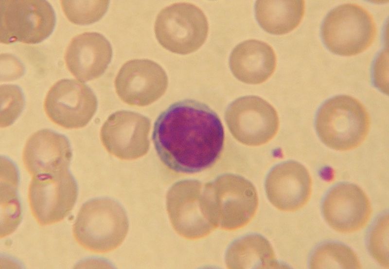 800px lymphocyte2