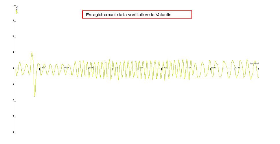 Graphique ventilation vierge