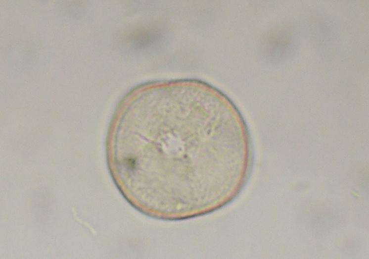Grass pollen 6864642413