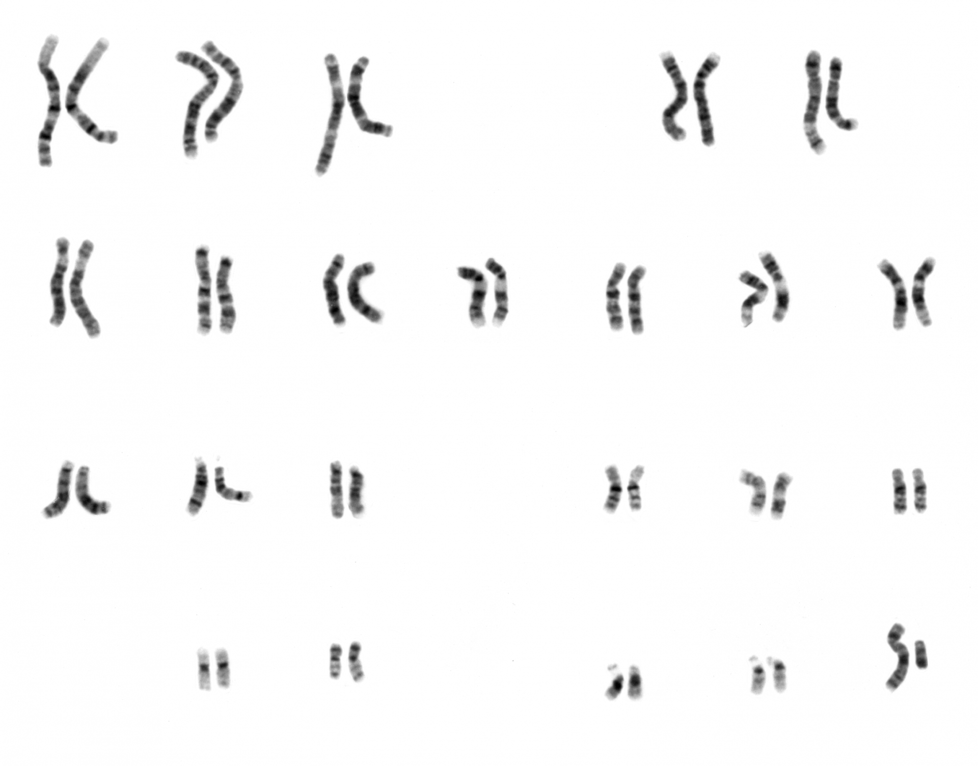 Nhgri human male karyotype