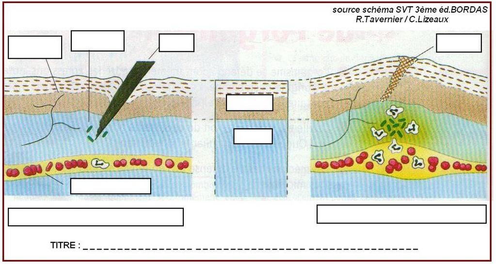 Reaction inflammatoire vivelessvt