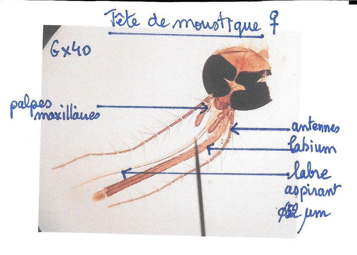 Tet emoustique