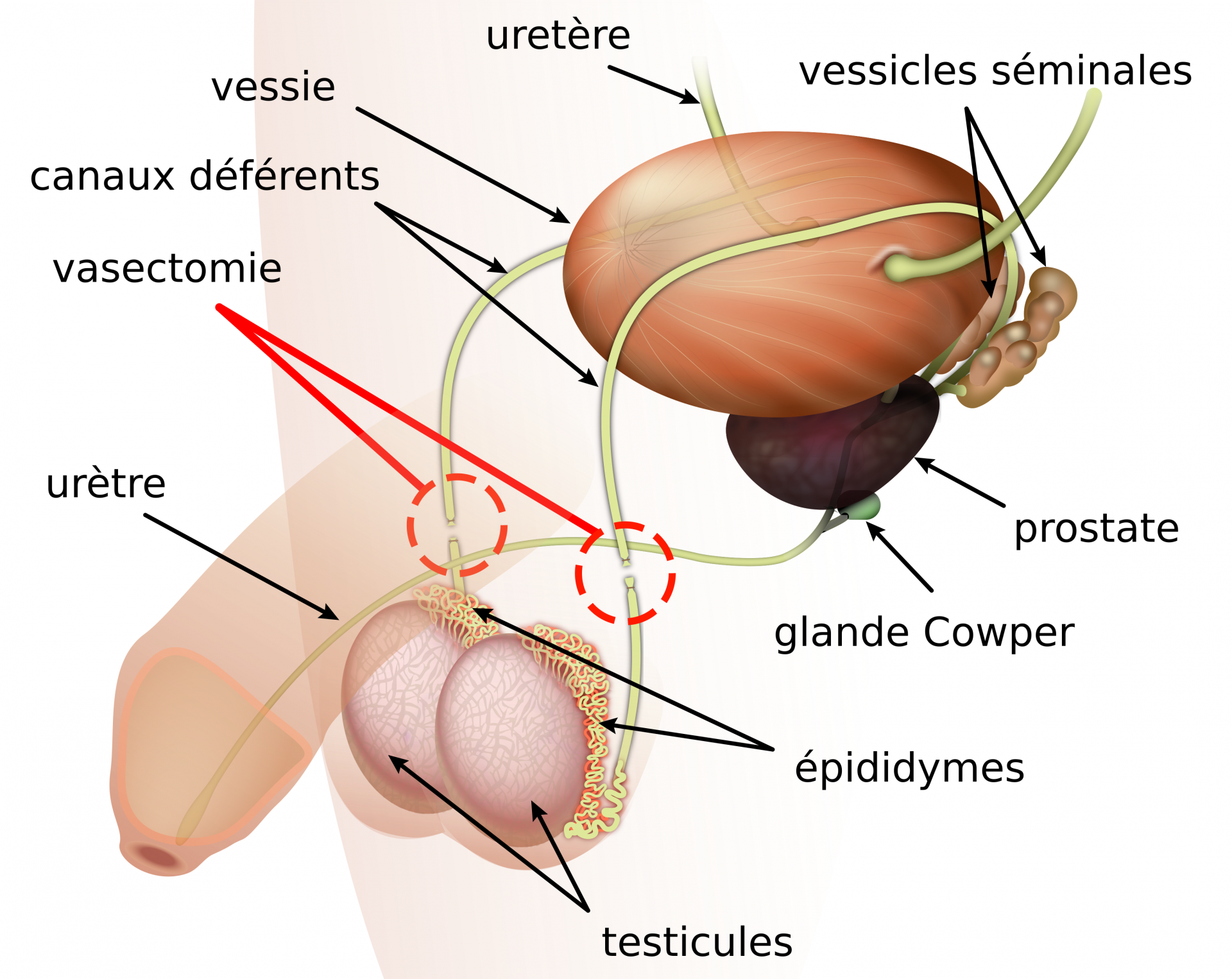 Vasectomie fr